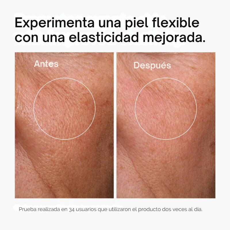 Ácido Hialurónico 2% + B5 |  Rejuvenecedor