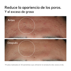 Niacinamida 10% | Sérum Vitamina B3