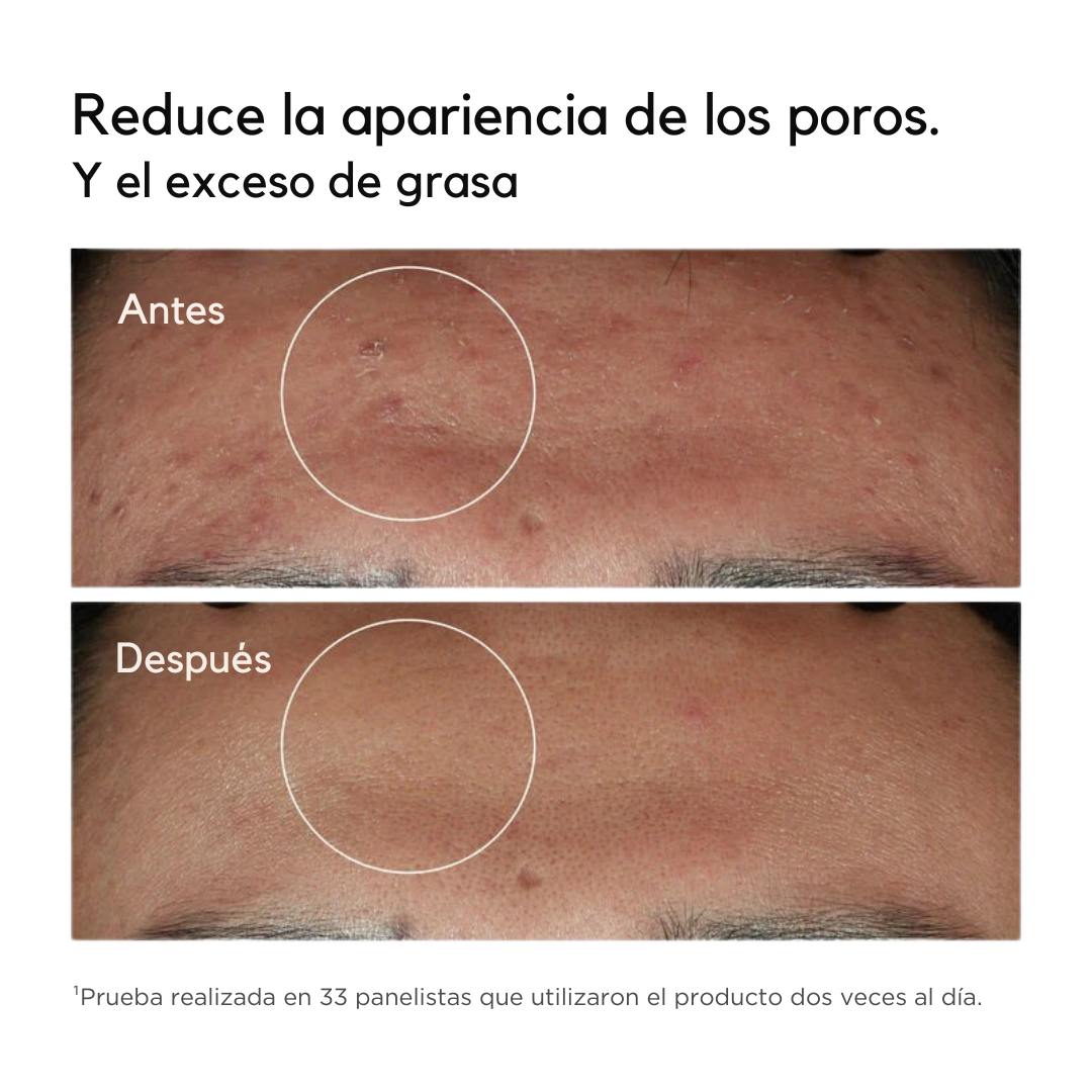 Niacinamida 10% | Sérum Vitamina B3